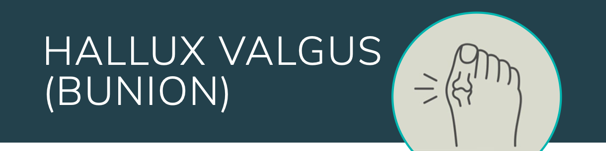 Striding Forward: Understanding and Managing Bunions and Claw Toes